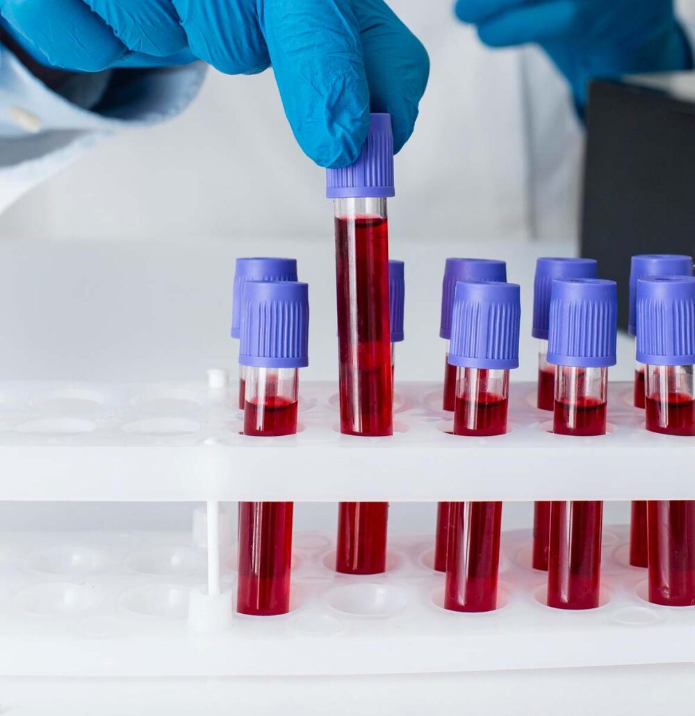 Analisi del sangue