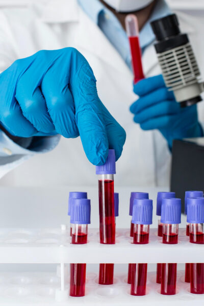 Analisi del sangue