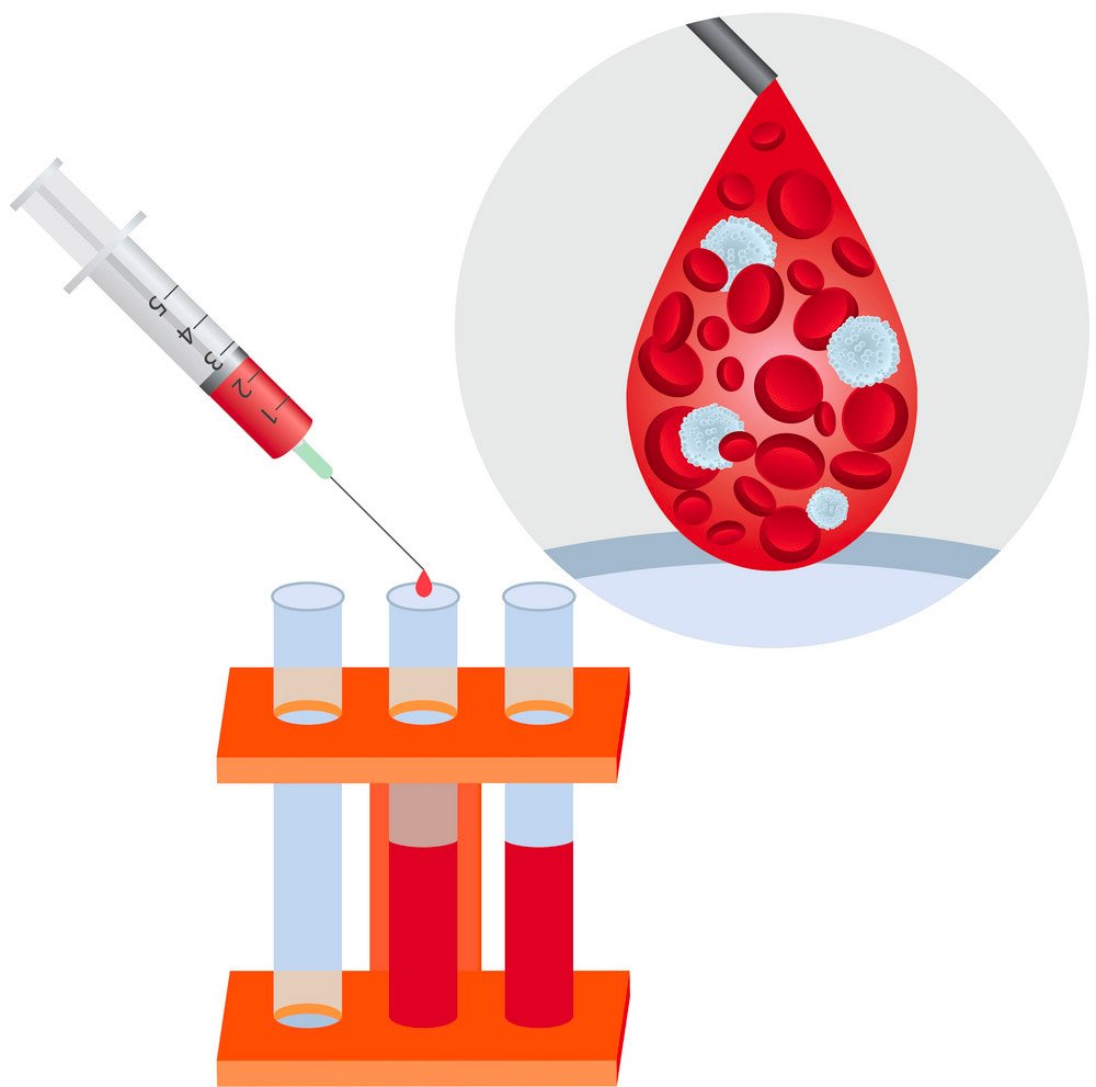 Analisi del sangue
