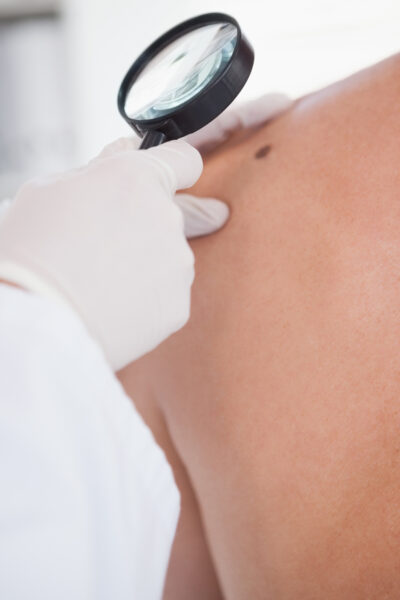 Teledermatologia