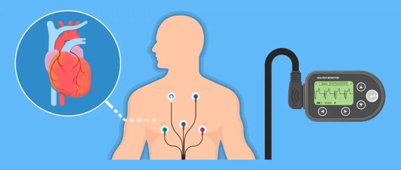 Holter cardiaco