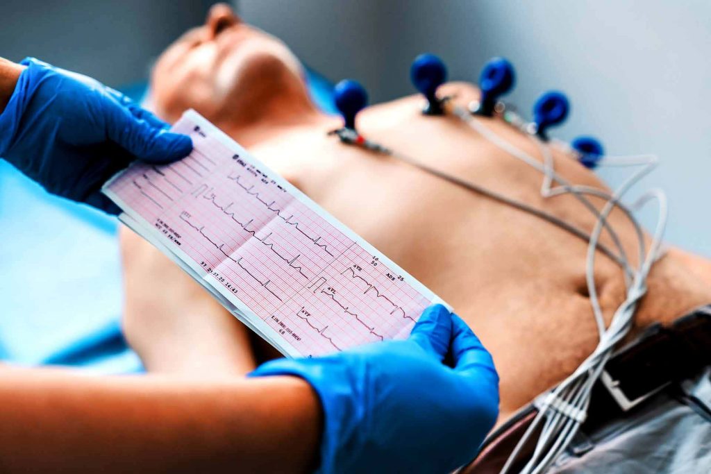 ECG Elettrocardiogramma
